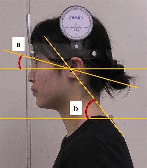 Two Sagittal Angles A Head Angle B Cervical Angle Download Scientific Diagram