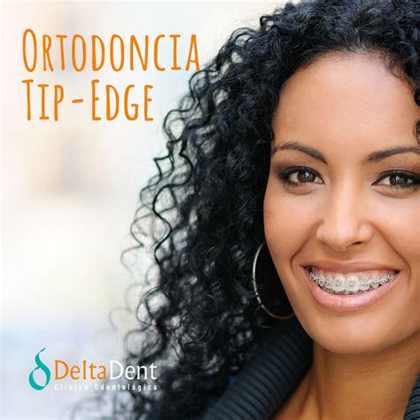 Ortodoncia Tip Edge Cl Nica Dental Deltadent