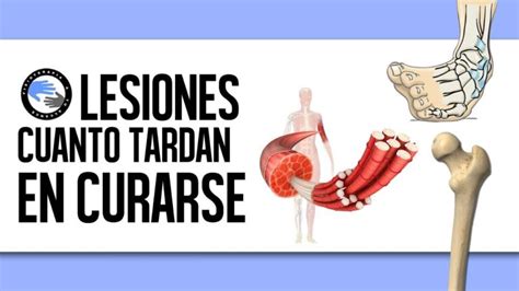 Guía completa Cuánto tiempo tarda en curarse una tendinitis de cadera