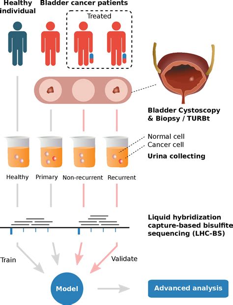 Frontiers Detecting And Monitoring Bladder Cancer With Exfoliated Cells In Urine