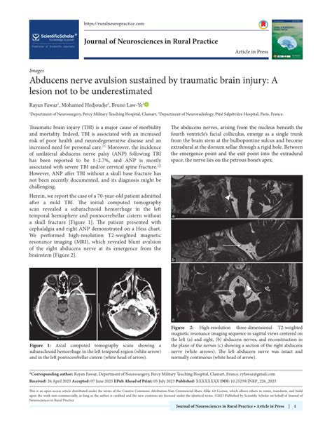 (PDF) Abducens nerve avulsion sustained by traumatic brain injury: A lesion not to be underestimated