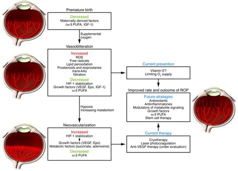 Jci Retinopathy Of Prematurity Understanding Ischemic Retinal Vasculopathies At An Extreme Of