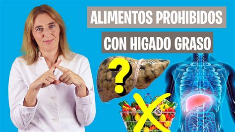 Qué ALIMENTOS están PROHIBIDOS para HÍGADO GRASO Qué no comer con