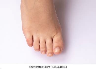 9 077 Naked Nails Images Stock Photos And Vectors Shutterstock