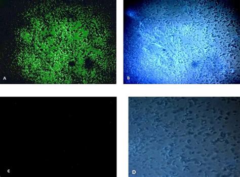 Calcofluor White Staining For Cellulose Detection 1 K Xylinus A The Download Scientific