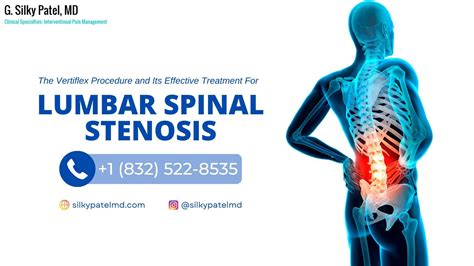 The Vertiflex Procedure And Its Effective Treatment For Lumbar Spinal