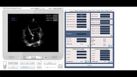 Linear Measurements Of The Left Ventricle Youtube