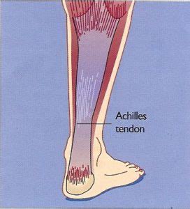 Ankle Procedures Dr Peter Smith Achilles Tendon