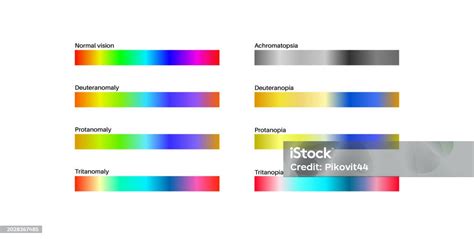 Color Blindness Poster Stock Illustration - Download Image Now - Artist ...