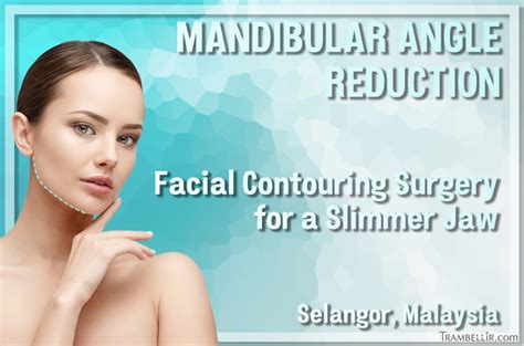 Mandibular Angle Reduction (Facial Contouring Surgery) | Trambellir