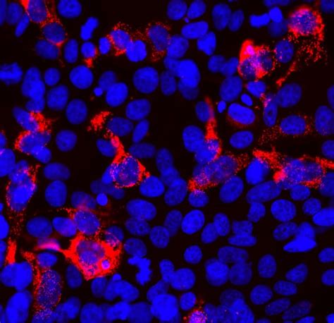 Anti-SARS-CoV-2 Spike Glycoprotein RBD antibody [5G8] (ab277628) | Abcam