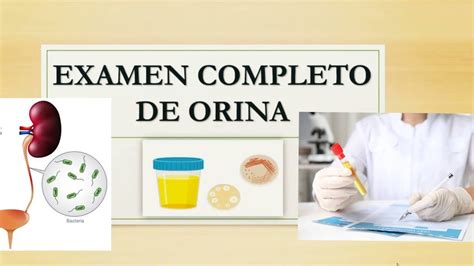 Gu A Completa Del Examen De Orina Todo Lo Que Necesitas Saber Para