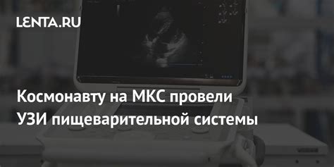 Космонавту на МКС провели УЗИ пищеварительной системы: Космос: Наука и ...