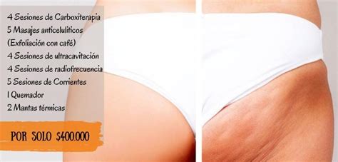 Tratamiento Anti Celulitis Ebes Spa Y Est Tica Salud Y Belleza En