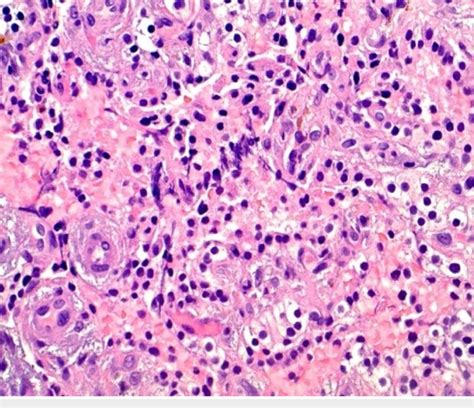 Photomicrograph Of Parathyroid Gland Using Hematoxylin And Eosin