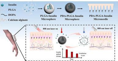 Light Responsive Microneedle Array With Tunable Insulin Release