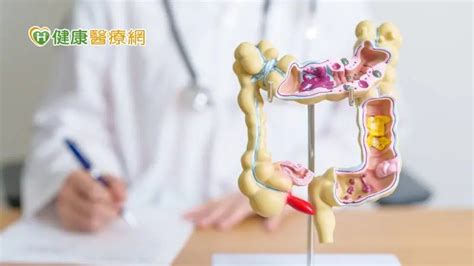 近9成大腸癌發生於「這年齡」！篩陽未做大腸鏡風險最高增64 新聞 Rti 中央廣播電臺