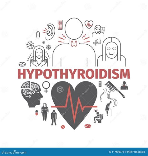 Hyperthyroidism. Symptoms, Treatment. Icons Set. Vector Signs Stock