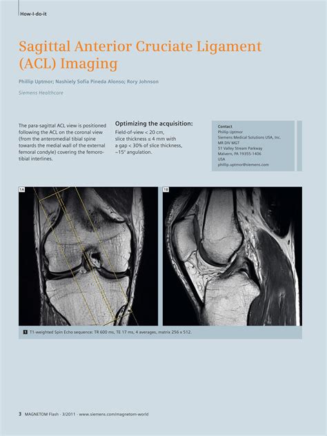 Anterior Cruciate Ligament Mri