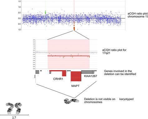 What Is Array Cgh Adc Education And Practice Edition