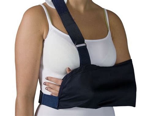 Вывих плеча