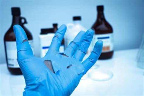 Use Torn Gloves When Working With Hazardous Chemical In The Laboratory