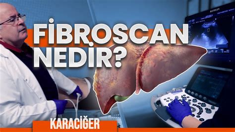 FİBROSCAN NEDİR NEDEN YAPILIR Karaciğer ölçümü Prof Dr Yusuf