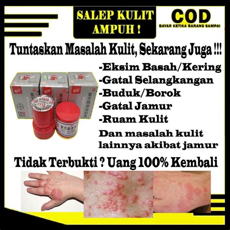 Jual Pi Kang Wang Salep Obat Cina China Untuk Gatal Kulit Jamur