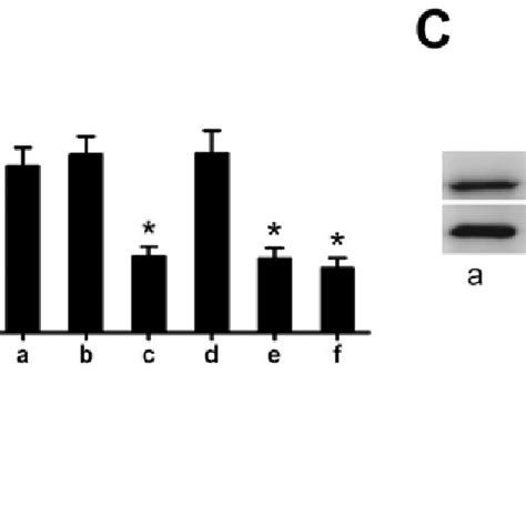 Il A Suppresses P Expression In Dlbcl Cells The Su Dhl Cells