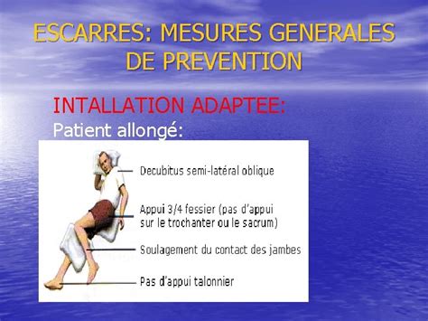 PREVENTION ET TRAITEMENT DES ESCARRES DE LADULTE DEFINITION