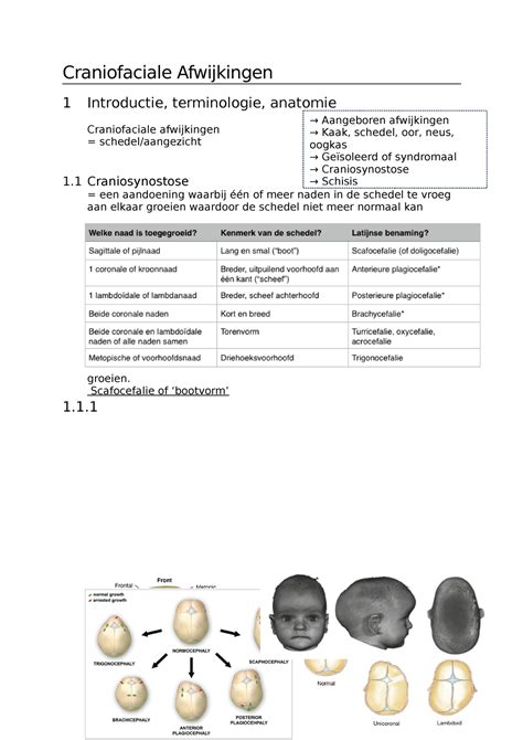 Samenvatting Craniofaciale Afwijkingen Craniofaciale Afwijkingen 1