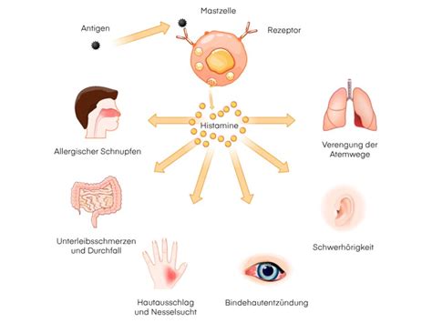 Was Tun Bei Histaminintoleranz Visana Blog