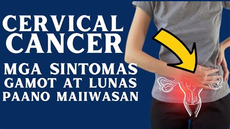 Mga Sintomas Ng Cervical Cancer Mga Sanhi At Dahilan Paano Ang Lunas