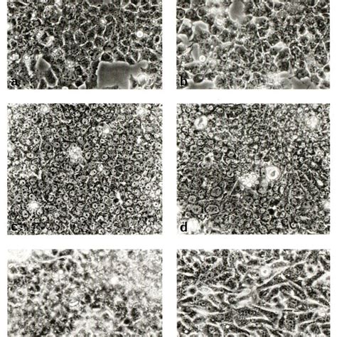 Phase Contrast Micrographs Of Cells Cultured In The Control Medium And