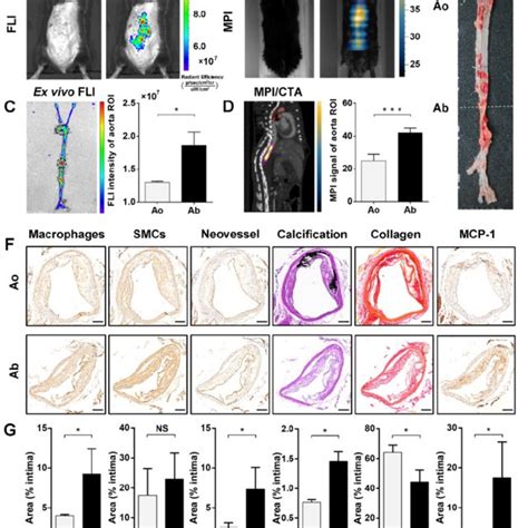 Identification Of Vulnerable Plaque Located In Abdominal Aorta Of Download Scientific Diagram