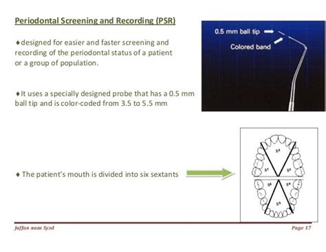 029periodontal Diagnosis And Prognosis