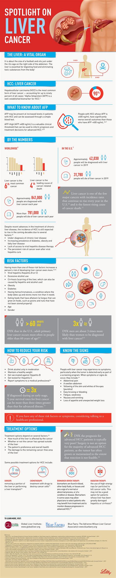 Spotlight On Liver Cancer Infographic The Business Press