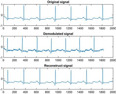 Signal During Compressive Sensing Technique Download Scientific Diagram