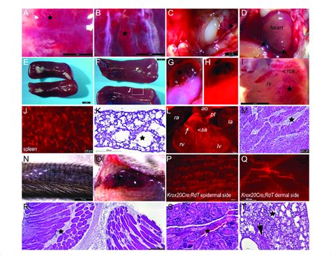 Anatomy And Histology Of Vascular Anomalies In Krox Cre Pik Ca