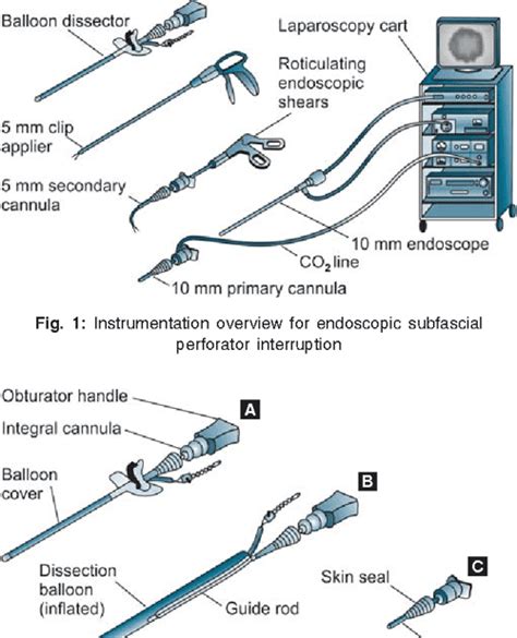 Subfascial Endoscopic Perforator Surgery In Perforator Vein