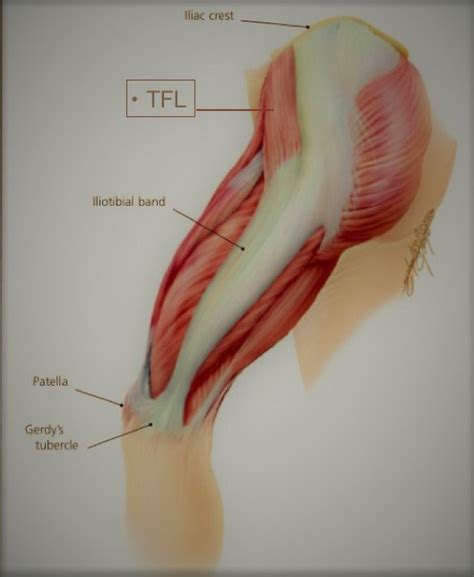 Ilio Tibial Band Syndrome ITB Syndrome Itb Syndrome Plantecuador