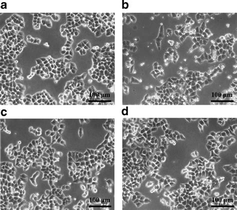 Effect of TSCH on the morphology of HepG2 cells. a Non-treated culture ...