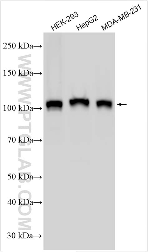 YTHDC1 antibody (29441-1-AP) | Proteintech