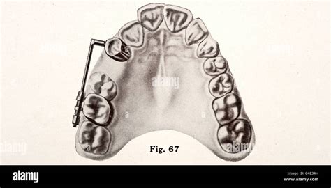 Dental papilla hi-res stock photography and images - Alamy