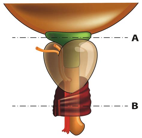 Male Urethral Sphincter Image Showing A The Internal Urethral