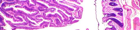 Adenoma treatment of Adenoma types Diseases, Index A –Z, medicines ...