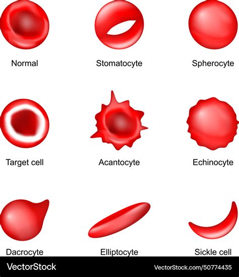 Shape of red blood cell diseases Royalty Free Vector Image