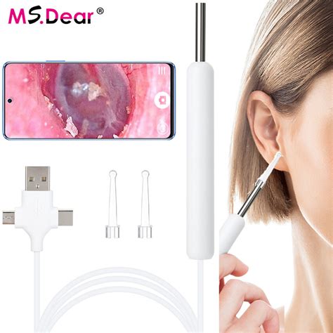 Visual Otoscope Ear Cleaning 3-in-1 HD Endoscope Ear Camera Oral Skin Examination Earwax ...