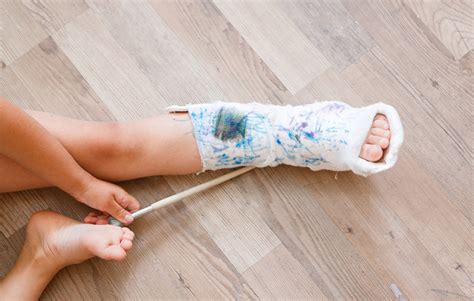 Orthopaedic Clinic Singapore Broken Bones In Children