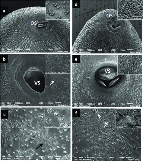 Scanning Electron Micrographs Showing The Effect Of M A B C And